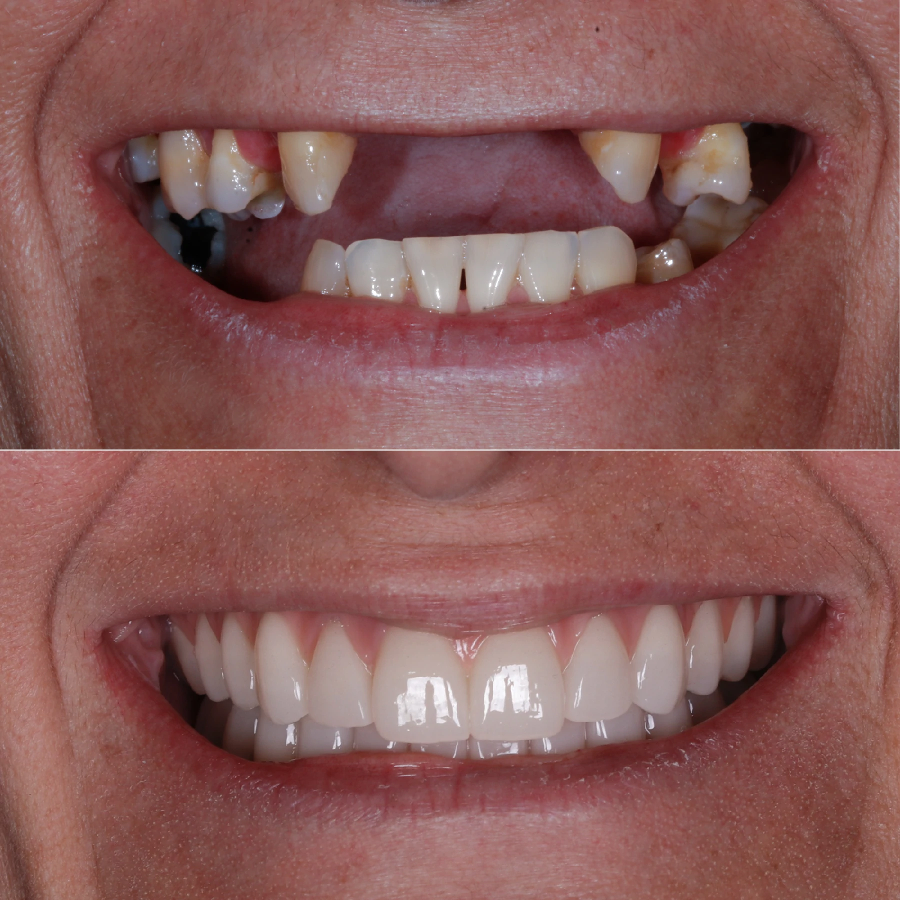IMPLANTES SITE DR DIEGO (10)