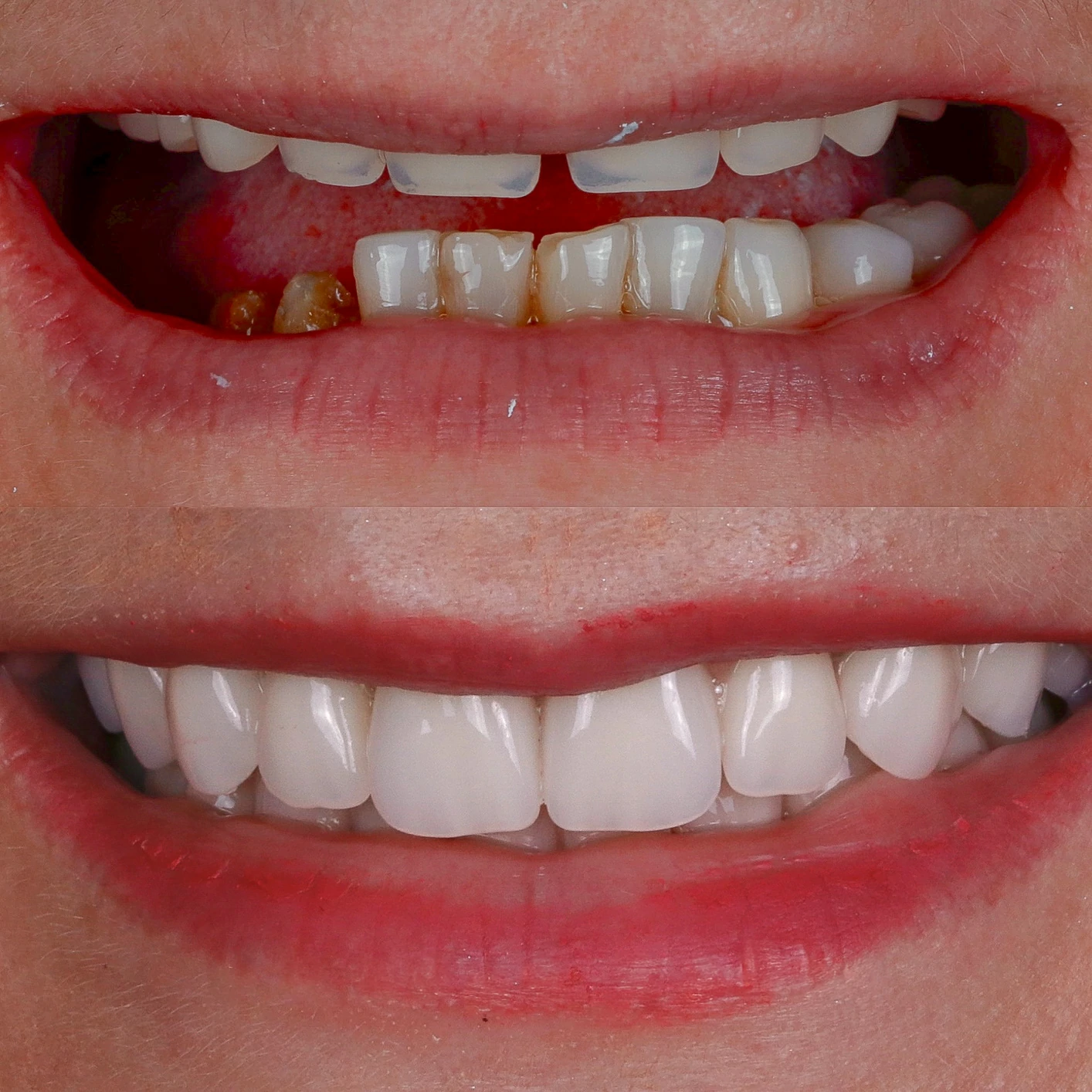 IMPLANTES SITE DR DIEGO (11)