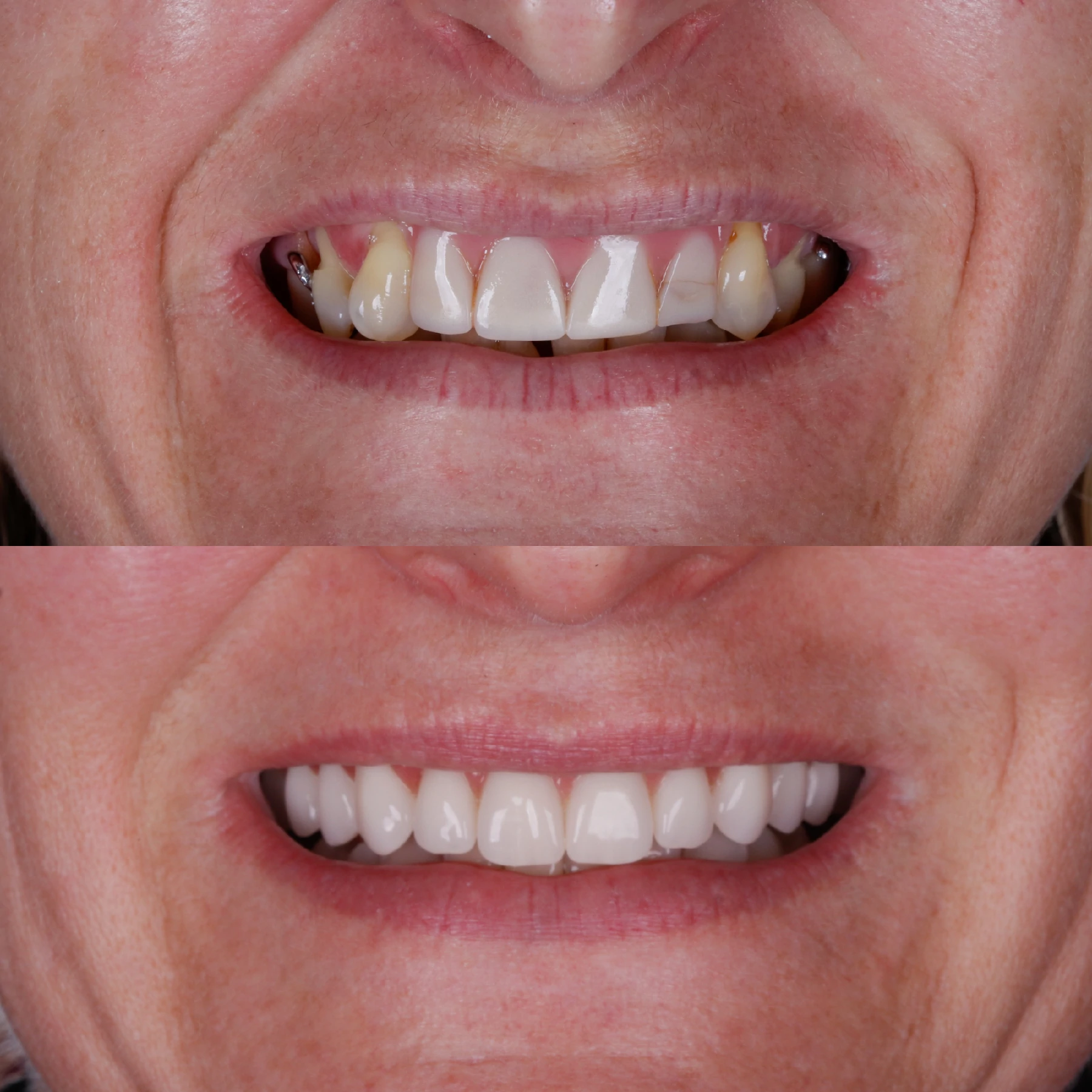 IMPLANTES SITE DR DIEGO (14)