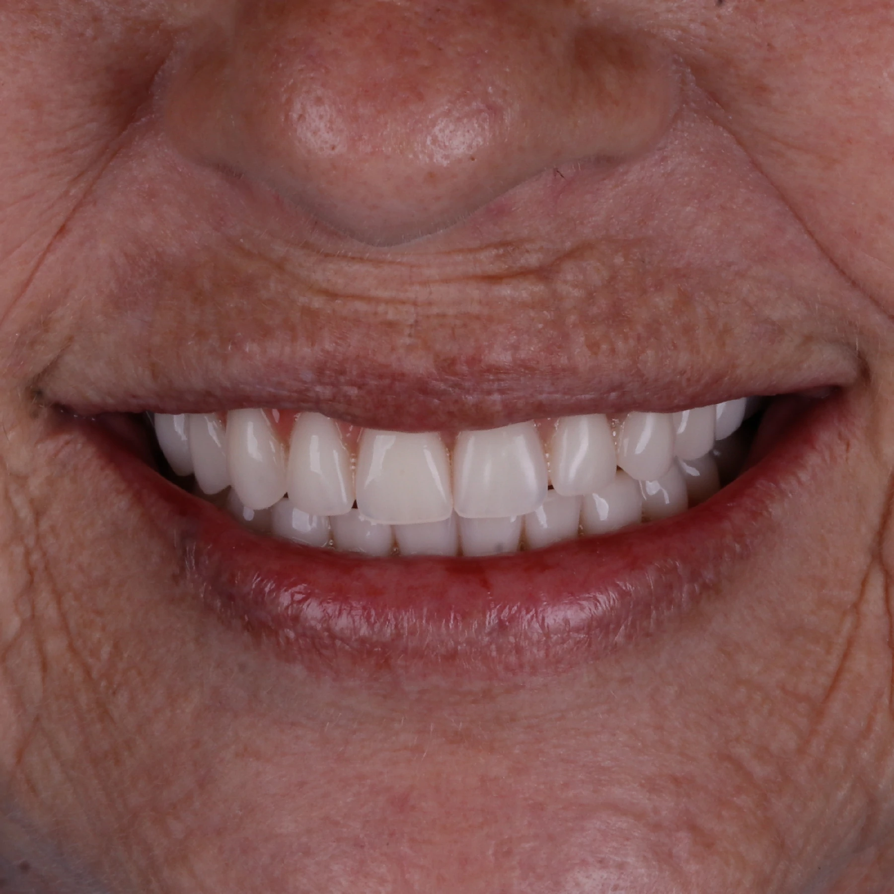 IMPLANTES SITE DR DIEGO (25)