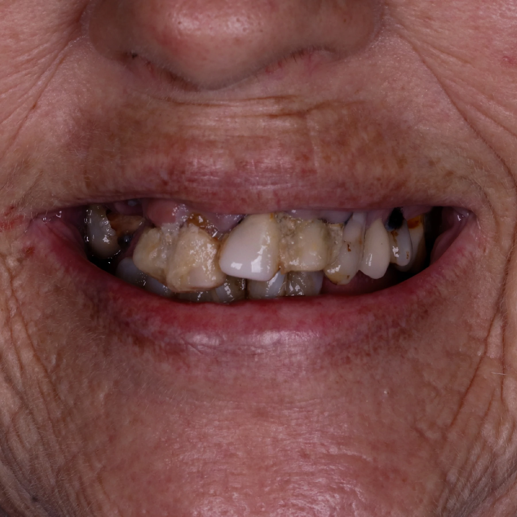 IMPLANTES SITE DR DIEGO (26)