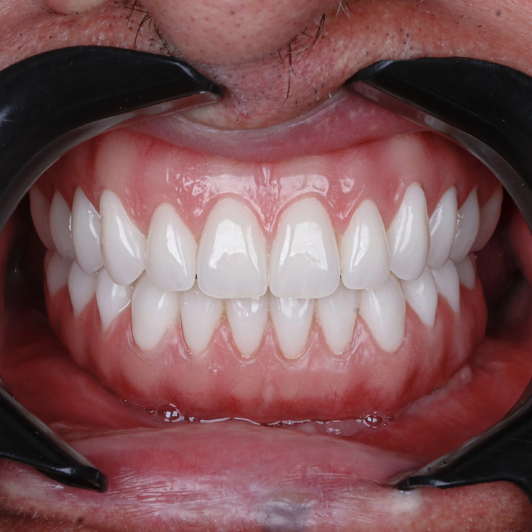 IMPLANTES SITE DR DIEGO (27)