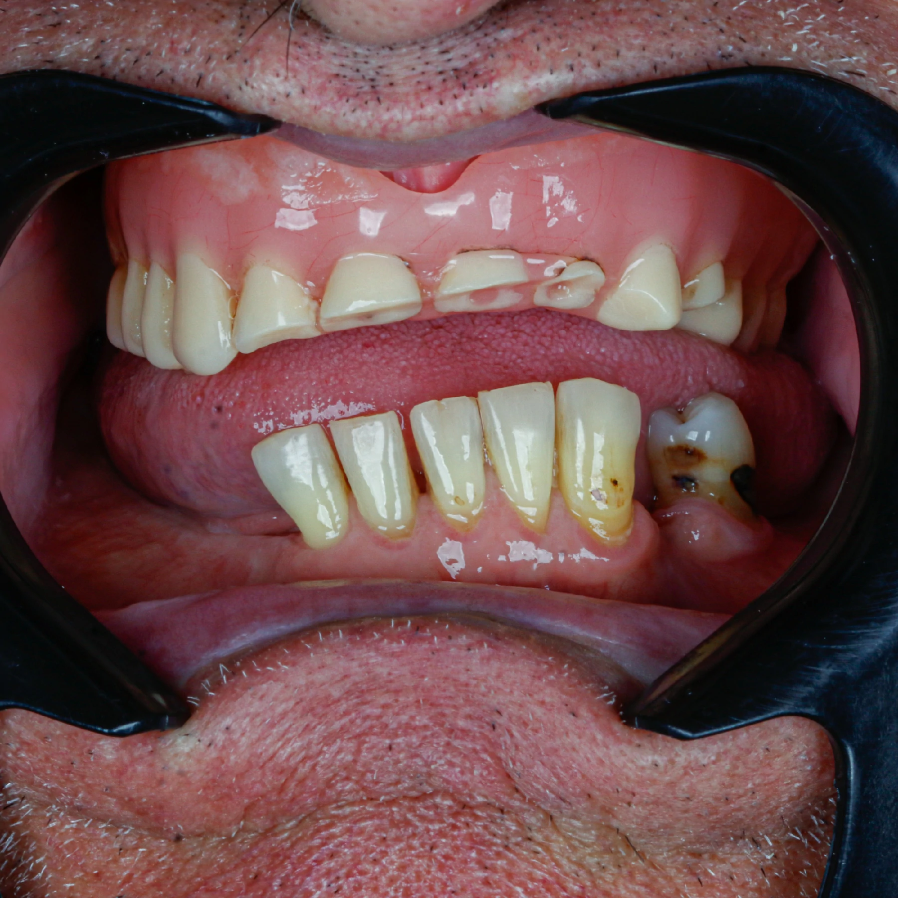 IMPLANTES SITE DR DIEGO (28)