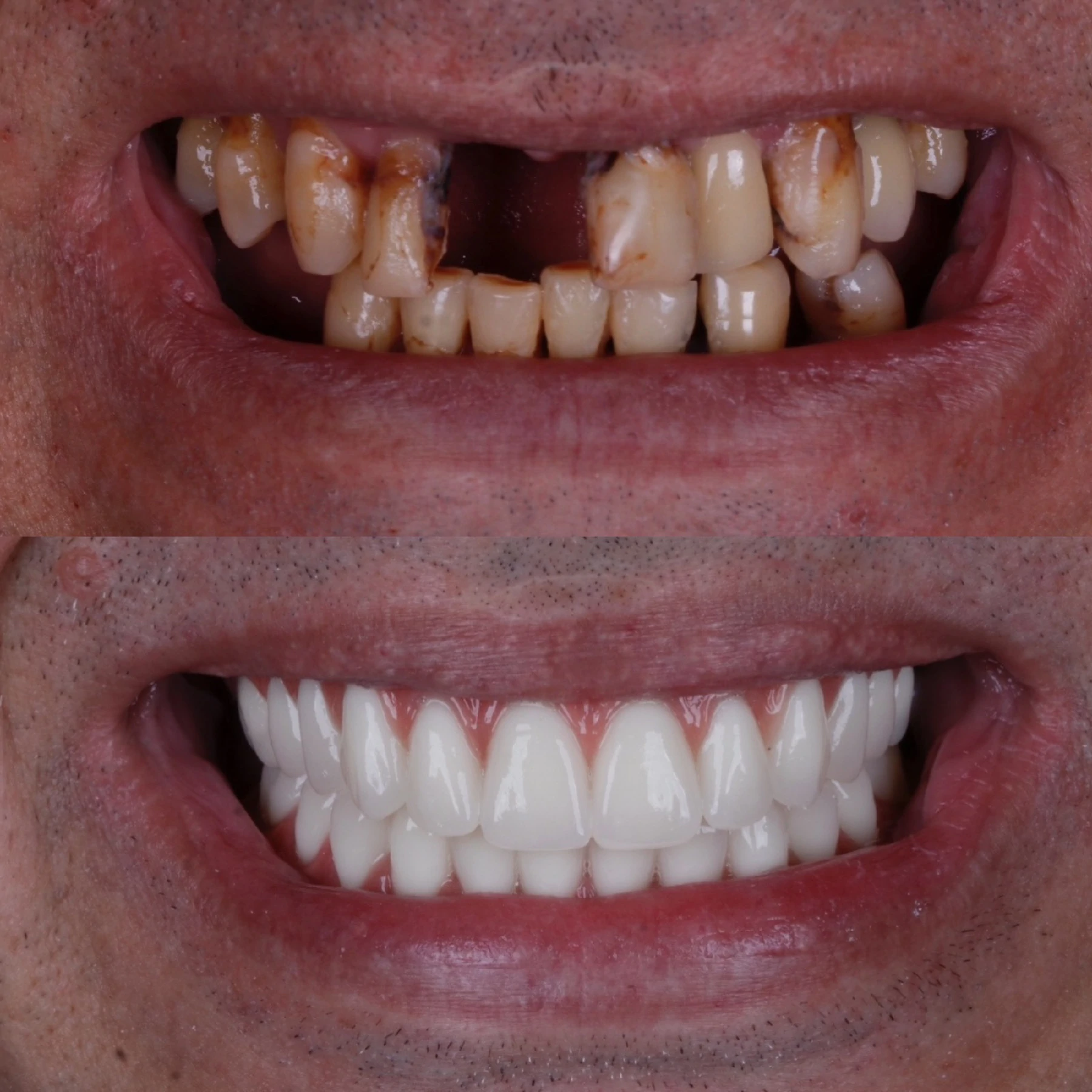 IMPLANTES SITE DR DIEGO (31)