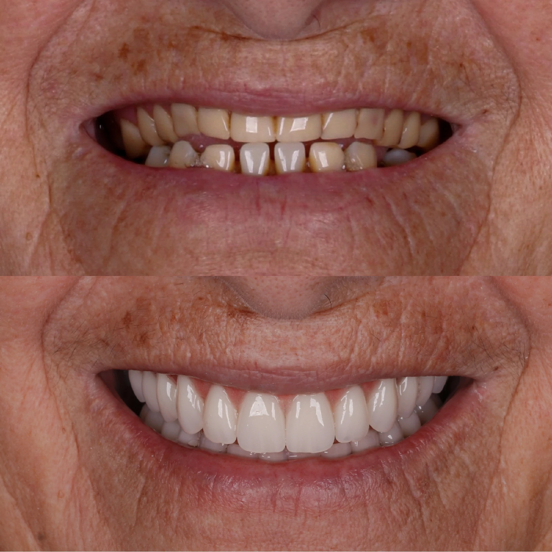 IMPLANTES SITE DR DIEGO (34)